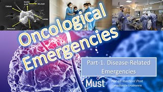 Oncological emergencies part1 [upl. by Devad223]