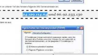 Tutorial DNS Einstellung ändern bei Vista [upl. by Iruj616]