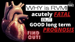 Understand Right Ventricular Myocardial Infarction in 12 mins [upl. by Ididn]