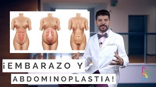 ¡RIESGOS DE UN EMBARAZO DESPUES DE UNA ABDOMINOPLASTIA [upl. by Orran853]