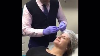 Dr Patel talks us through the Blanching technique for frown lines [upl. by Jerz]