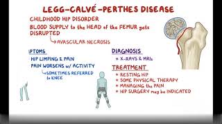 Legg Calve Perthes Disease Causes Symptoms Diagnosis amp Treatment Pathology [upl. by Ker]