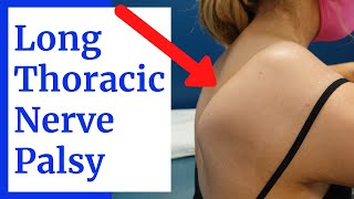 Long Thoracic Nerve Palsy Shoulder Blade Winging Evaluation [upl. by Wiseman367]