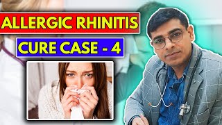 Allergic Rhinitis CURE Case No 4  Homeopathy Treatment for Allergic Rhinitis  Dr Abhik Ghosh [upl. by Ferrell284]