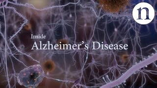 Inside Alzheimer’s disease [upl. by Narib566]