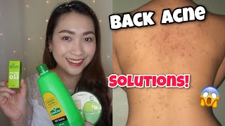 SIMPLENG SOLUSYON SA BACK ACNE AT BUTLIG BUTLIG SA KATAWAN  ayaesguerra [upl. by Ibur]