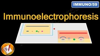 Immunoelectrophoresis FLImmuno59 [upl. by Dinan]