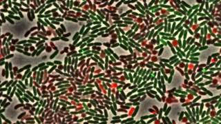 Dueling between green Pseudomonas aeruginosa cells ClpVGFP and killing of [upl. by Araht310]