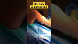 Stiff Knee Demonstration ✓✓✓✓ [upl. by Yerffoej96]