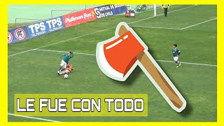 Pequeño Central de Santiago Wanderers recibe fuerte falta [upl. by Dehsar]