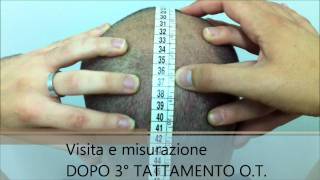 OSTEOPATIA TRICOLOGICA METODO DAMBRA TEST [upl. by Hesler207]