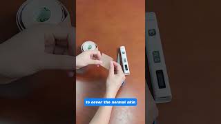 How to cover the normal skin during vitiligo uv treatment vitiligotreatment [upl. by Auqenaj562]