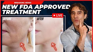 REMOVE JOWLS amp TIGHTEN YOUR FACE WITHOUT SURGERY Everything You Need To Know NEW Approved Procedure [upl. by Laenej575]