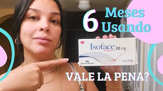 Mi experiencia usando ISOTRETINOINA por seis meses [upl. by Preston]