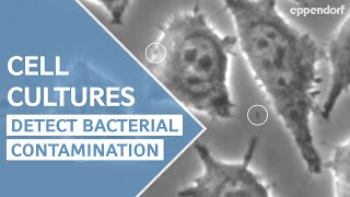 How to detect bacterial contamination in cell culture  moving particles are not always bacteria [upl. by Ramonda]