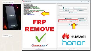 Honor X6a FRP UNLOCK  WDYLX3 GOOGLE ACCOUNT REMOVE  HONOR FRP KEY  UnlockPrice [upl. by Tillie806]