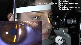 Ophthalmic Skills Series Part 15 [upl. by Enilesor321]