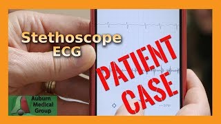 Stethoscope ECG  Auburn Medical Group [upl. by Leahcimed]