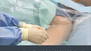 Having a Peripherally Inserted Central Catheter – PICC Arabic [upl. by Lahcsap]