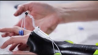 Dorsal wrist orthosis Orfilight Black with Orfitube outrigger  Splinting techniques 810 [upl. by Afas]