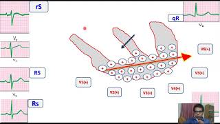 EKG Lec3 Chest leads and morphology of QRScomplex by Dr Hasanat [upl. by Ramirolg312]