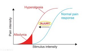 Hyperalgesia And Allodynia Explained  What is the definition of Hyperalgesia [upl. by Norat281]