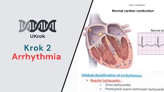 KROK 2  Arrhythmia All Types amp related NEW Krok questions [upl. by Linders220]