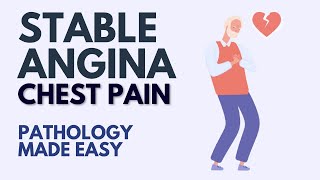 Stable Angina l Chest Pain l Pathology Made Easy [upl. by Orag]