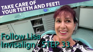 🦷 Invisalign 33  POST WIRE 6 month checkup  take care of your teeth and feet  Follow Lisa [upl. by Allenrad]