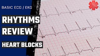 Basic ECG EKG Part 5 Heart Blocks [upl. by Ahsrats]