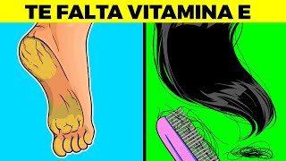 SEÑALES DE QUE TE FALTA VITAMINA E Y NO SABÍAS [upl. by Tanner]