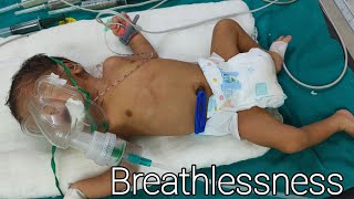 Breathing problem in Newborn babyBreathlessness amp Grunting newborn [upl. by Arman]