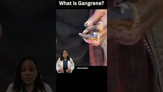 What is Gangrene [upl. by Collie]