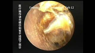 Differences in 3 types of ear conditions [upl. by Kenison]