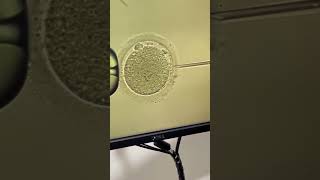 ICSI Intra cytoplasmic sperm injection technique bookplusacademy [upl. by Gun]