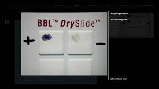 Oxidase Test DrySlide  Microbiology [upl. by Ettenav614]