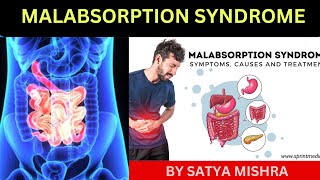 Malabsorption Syndrome  child health Nursing Online Nursing Classes  Easy Explanation in Hindi [upl. by Aneryc]