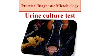 Urine culture test  micro lab 2 [upl. by Arral]