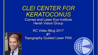 CLEI Center For Keratoconus  TopographyGuided PRK for Keratoconus  Episode 7 [upl. by Spillar951]