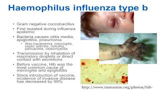 Poliomyelitis  Symptoms and Prevention [upl. by Kleiman59]