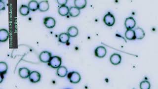 Blutmikroskopie – Tiefe Einblicke Dunkelfeldmikroskopie mit invertierten Bildern 🔬🔬🔬 [upl. by Adekam]