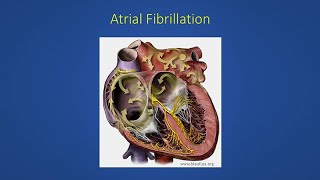 Normal Skipped or Irregular Heart Beats [upl. by Jaquelyn]