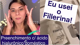 FILLERINA cÁcido Hialurônico pPreenchimento Rugas e Depressões CutâneasAqui todos detalhes [upl. by Hsepid]