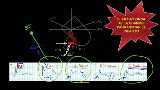 CURSO DE ELECTROCARDIOGRAFIA 35  EL VECTOR ST [upl. by Tatianas]