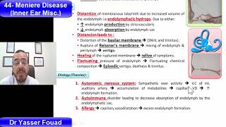 44 Meniere Disease [upl. by Melba]